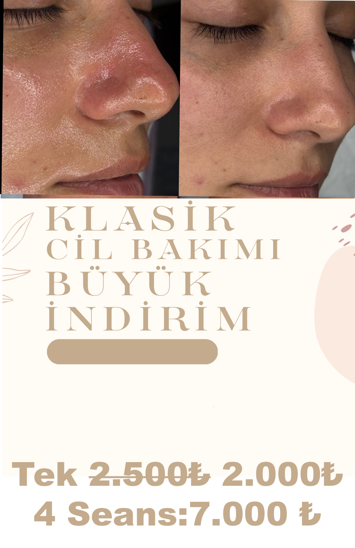 Klasik Cilt Bakımı